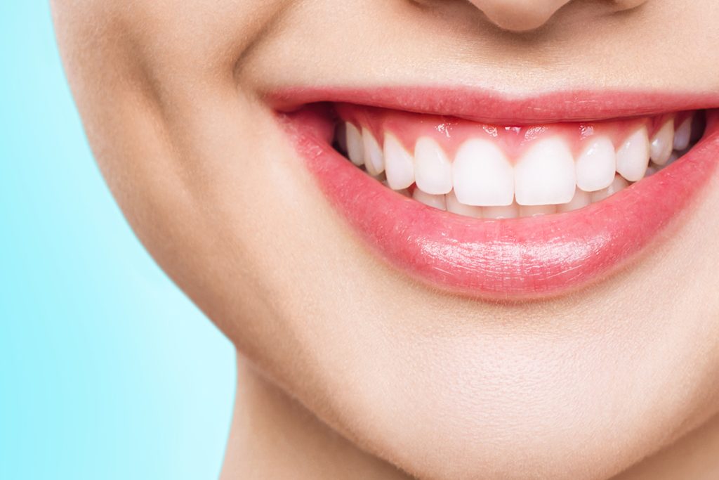 Brighten Your Smile: The Benefits of Teeth Whitening at Omaha Family Dental